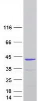 Human TNNT3 Protein (Recombinant Myc-DDK (Flag))