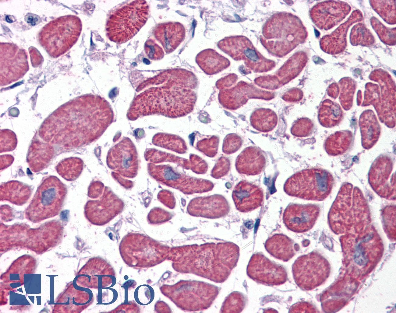 IHC-plus™ Polyclonal Goat anti-Human PDE4D Antibody (aa796-809, IHC, WB)