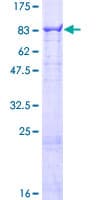 Human CFHR5 Protein (Recombinant GST)