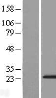 ZMAT5 Protein (Over-Expression Lysate Myc-DDK (Flag))