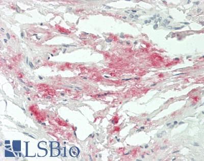 IHC-plus™ Polyclonal Rabbit anti-Human MMP20 Antibody (Internal, IHC, WB)
