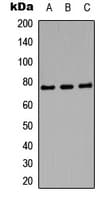 Polyclonal Rabbit anti-Human AMPH / Amphiphysin Antibody (Internal, WB)