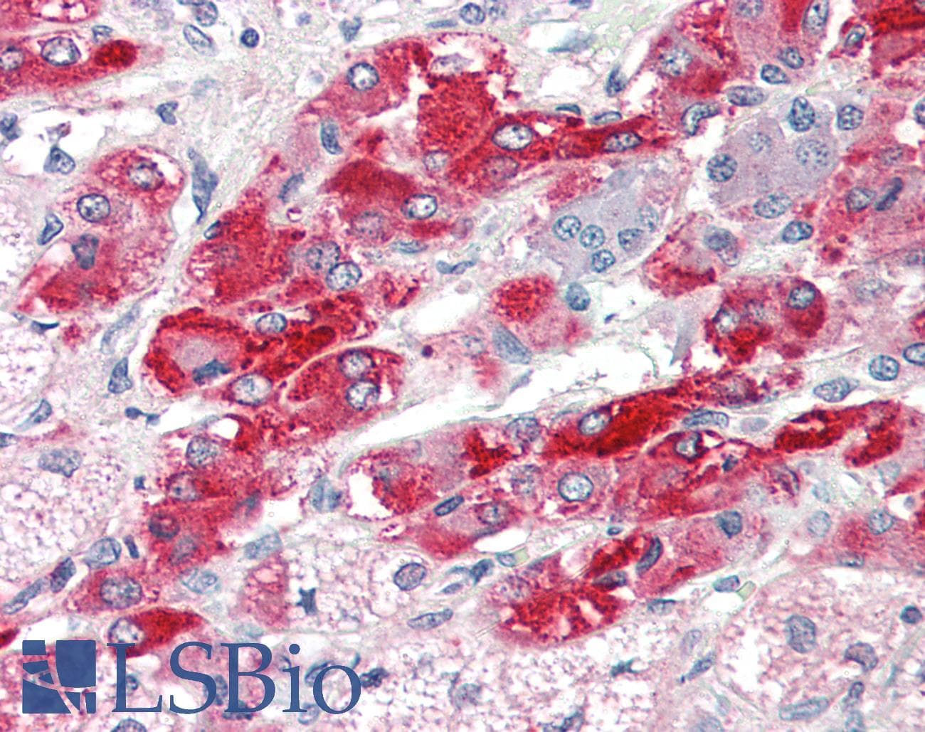 IHC-plus™ SLC18A2 / VMAT2 Antibody (C-Terminus)