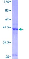 Human LCN2 / Lipocalin 2 / NGAL Protein (Recombinant GST)