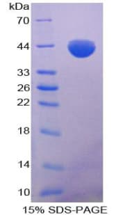 Pig CCL2 / MCP1 Protein (Recombinant His-GST)