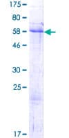 Human NRIP2 Protein (Recombinant GST)