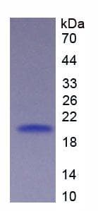Human CD27 Protein (Recombinant His, N-Terminal)