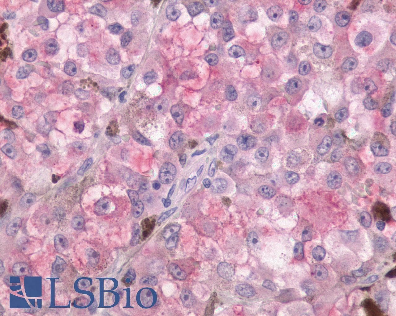 PathPlus™ Polyclonal Rabbit anti-Human MTNR1A / Melatonin Receptor 1a Antibody (Cytoplasmic Domain, IHC)