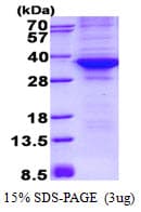 Human CDK4 Protein (Recombinant His)