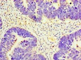 GNRH2 Antibody (aa24-120)