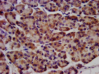 Polyclonal Rabbit anti-Human RAF1 / RAF Antibody (aa1-648)
