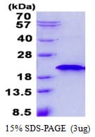 Human RNF181 Protein (Recombinant His)