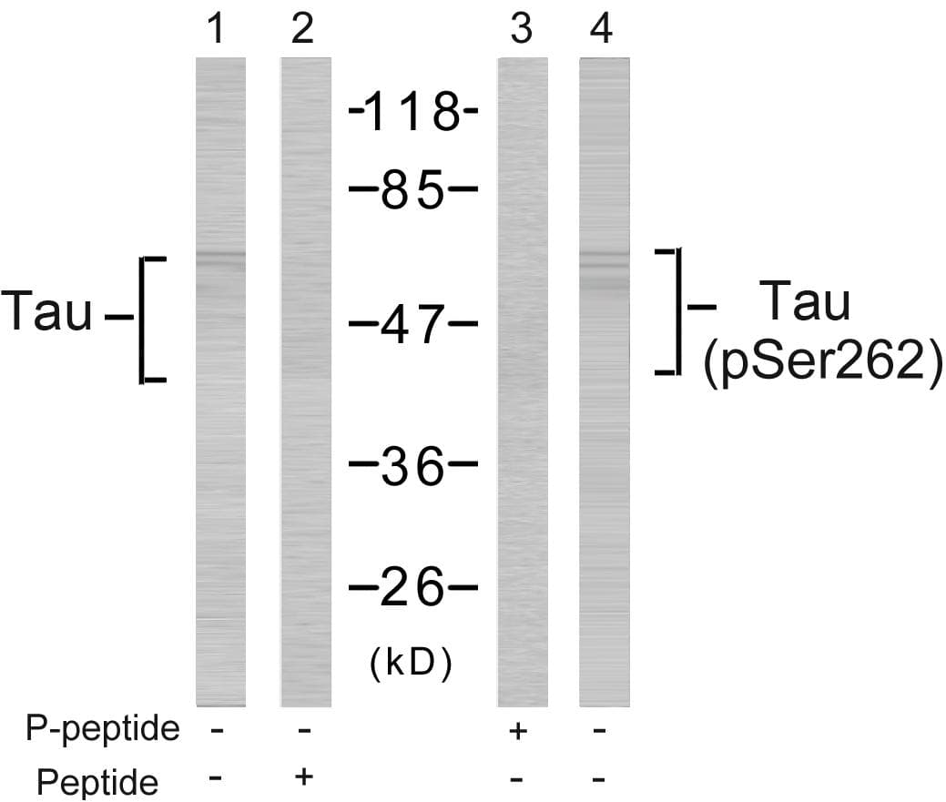 MAPT / Tau Antibody (phospho-Ser262)
