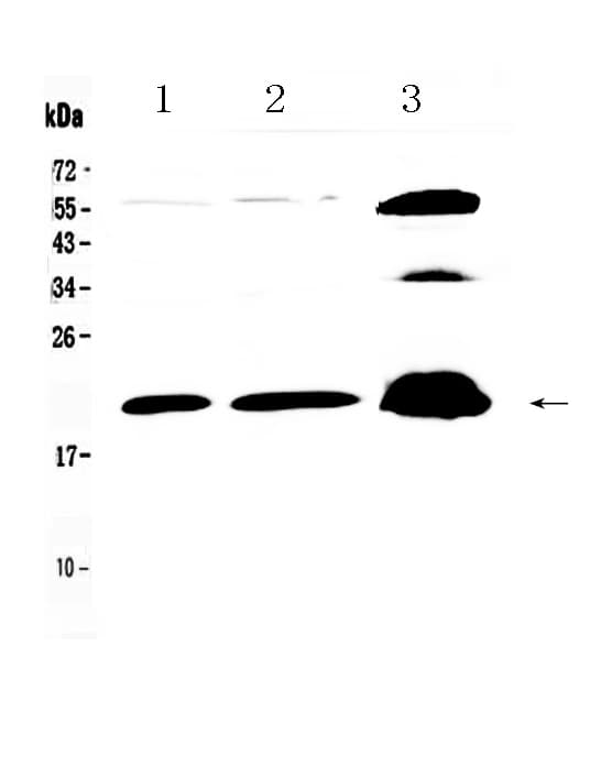 PPP1R14A / CPI-17 Antibody