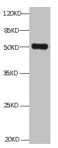 Monoclonal Mouse anti-Human ANXA2 / Annexin A2 Antibody (clone 1A1E1, IHC, WB)