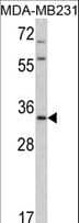Polyclonal Rabbit anti-Human 15-PGDH / HPGD Antibody (aa184-212, IHC, WB)