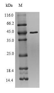 Anaplasma phagocytophilum rplV Protein (Recombinant 10His-SUMO, N-terminus + Myc, C-terminus)