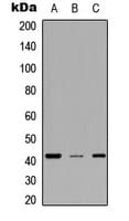 MESP2 Antibody (Internal)