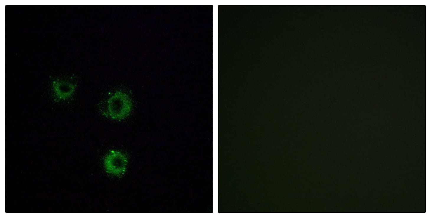 TAS2R14 / TRB1 Antibody (aa229-278)