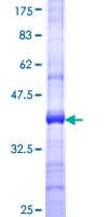 Human MLKL Protein (Recombinant GST, N-terminus)