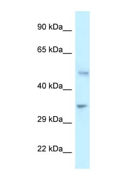 PFKFB1 Antibody (C-Terminus)
