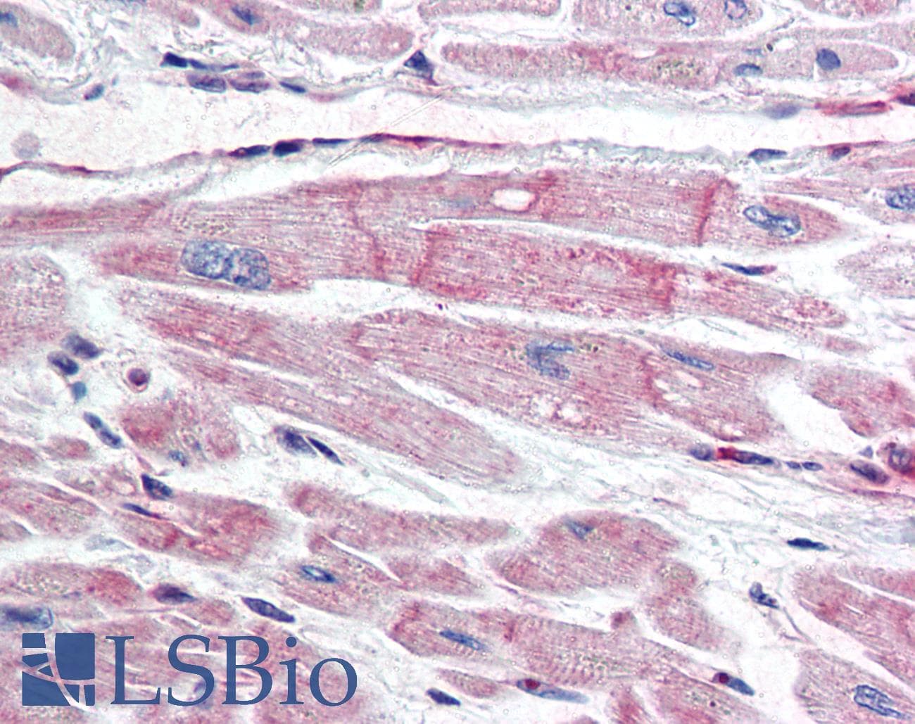 IHC-plus™ Monoclonal Mouse anti-Human BIRC7 / Livin Antibody (clone 88C570, IHC, WB)