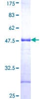 Human Junctin / ASPH Protein (Recombinant GST, N-terminus)