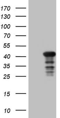 Monoclonal Mouse anti-Human CIAPIN1 / Anamorsin Antibody (clone OTI2B3, Carrier-free, aa97-312, WB)