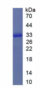 Mouse Rho Kinase / ROCK1 Protein (Recombinant 6His, N-terminus)