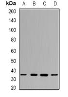 Polyclonal Rabbit anti-Human PPP4C Antibody (IHC, IF, WB)