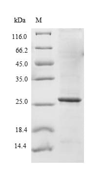 Human SLC5A2 / SGLT2 Protein (Recombinant 10His, N-terminus + Myc, C-terminus)