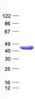 Human SERPINB1 Protein (Recombinant His, N-Terminal)