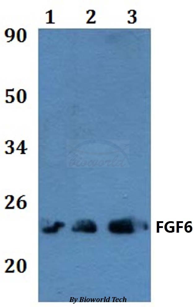 Polyclonal Rabbit anti-Human FGF6 Antibody (WB)