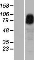 ANKRD6 / Diversin Protein (Over-Expression Lysate Myc-DDK (Flag))