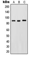 IKBKB / IKK2 / IKK Beta Antibody (phospho-Tyr188)