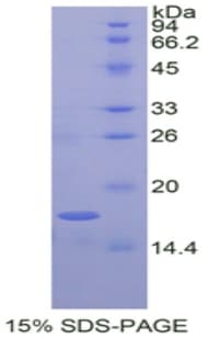 Bovine ANGPTL4 Protein (Recombinant His)