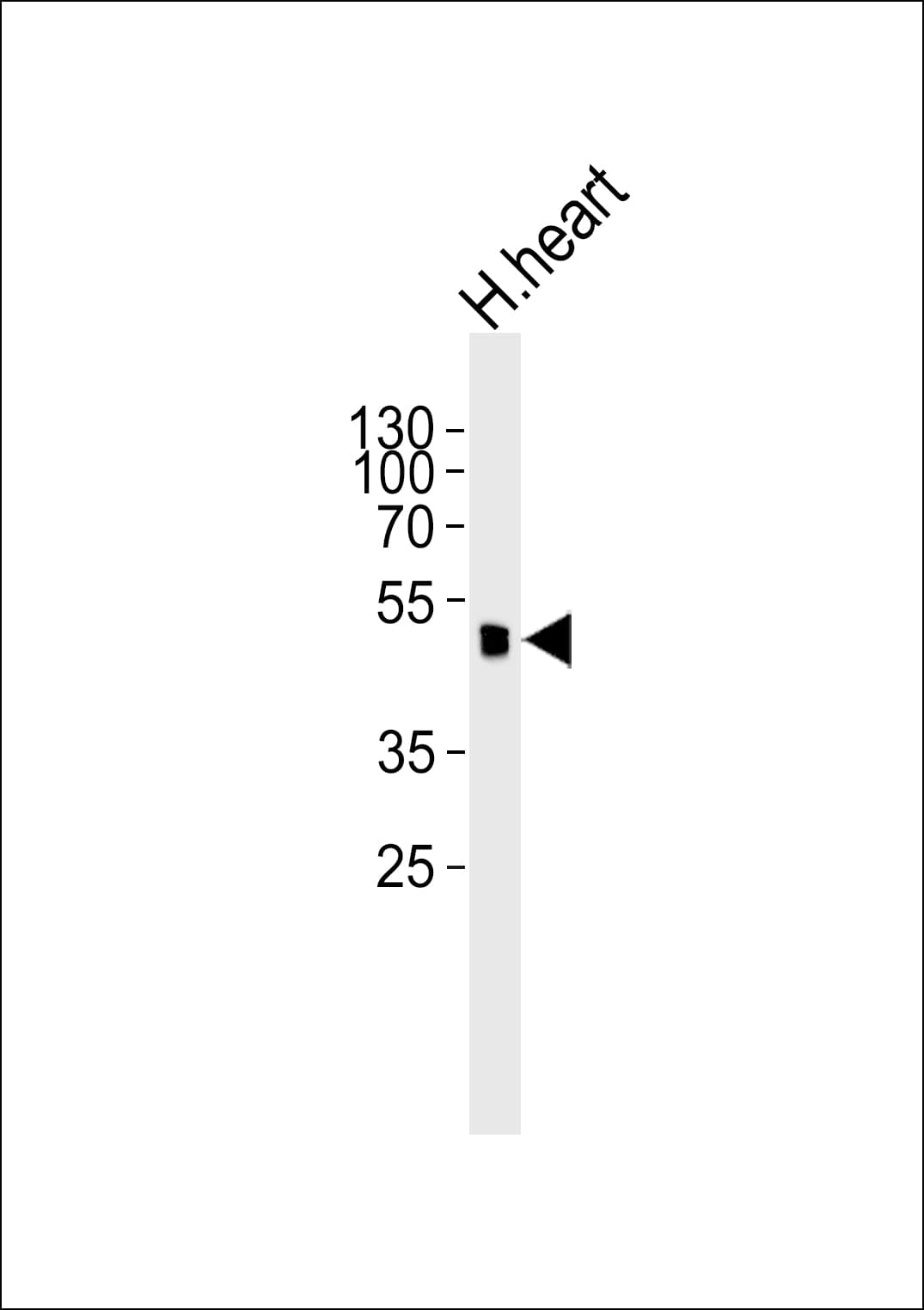 SLC2A4 / GLUT-4 Antibody (aa495-529)