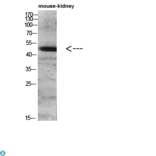 LAMP3 / CD208 Antibody