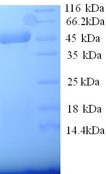Pig SELE / CD62E / E-selectin Protein (Recombinant His)