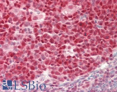 IHC-plus™ Polyclonal Rabbit anti-Human TCEA1 / TFIIS Antibody (aa200-250, IHC, WB)