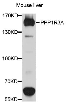 PPP1R3A / GM Antibody