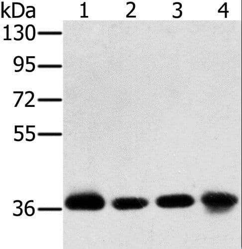 Polyclonal Rabbit anti-Human PDLIM1 Antibody (WB)