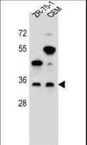 GPM6B Antibody (aa1-30)