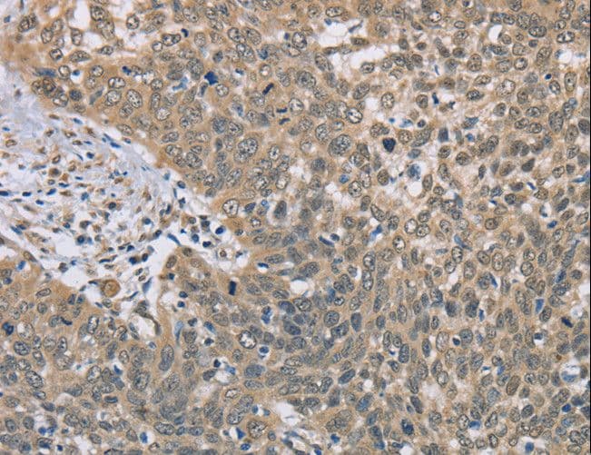DACH2 Antibody
