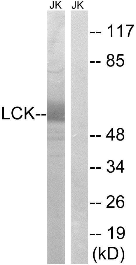 p56lck / LCK Antibody (p59)