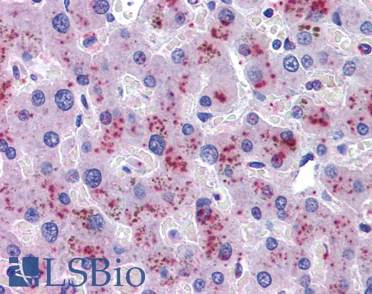 IHC-plus™ HPX / Hemopexin Antibody (aa32-45)