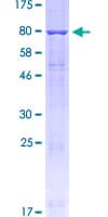 Human MAC-2-BP / LGALS3BP Protein (Recombinant GST, N-terminus)
