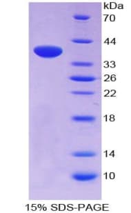 Mouse Neuropeptide S / NPS Protein (Recombinant His-GST)