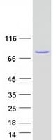 Human PRKCB / PKC-Beta Protein (Recombinant Myc-DDK (Flag))