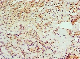 Polyclonal Rabbit anti-Human IL1RAP Antibody (aa21-356, IHC)